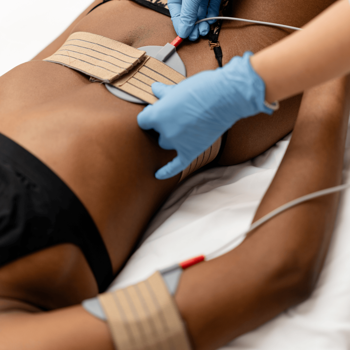 L'électrostimulation musculaire preview article image