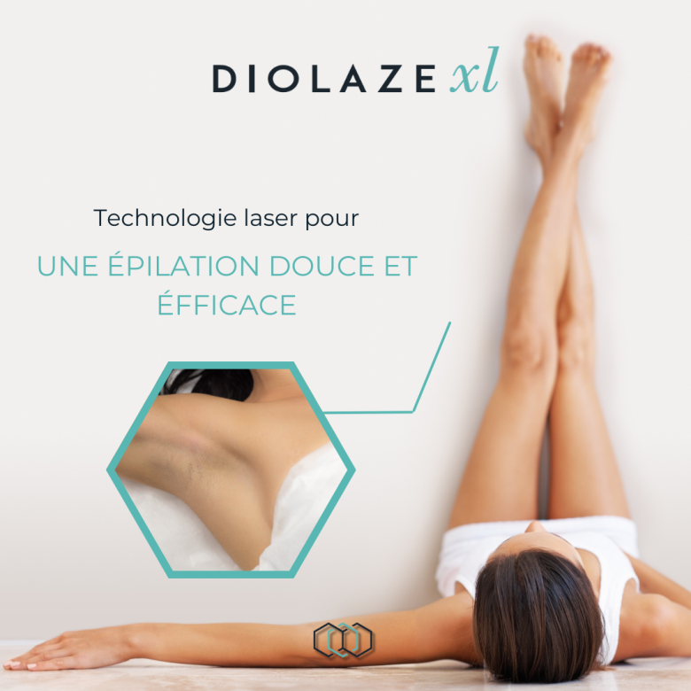 L’épilation au laser - image 2 of 9