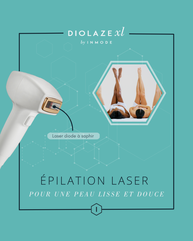 L’épilation au laser - image 3 of 9